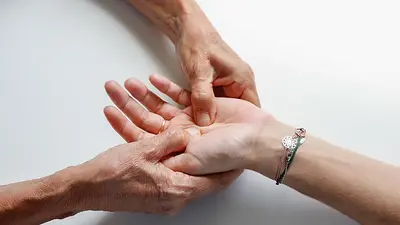 Krzywe palce u rąk na zdjęciach – odkryj ich piękno