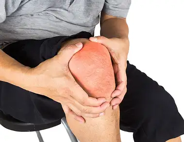 Naciągnięte ścięgno w kolanie – objawy, które warto rozpozna