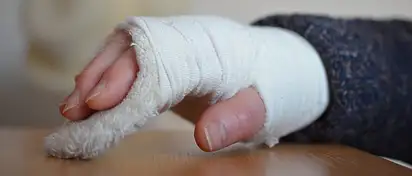 Krzywa ręka po gipsie: prosty powrót do zdrowia