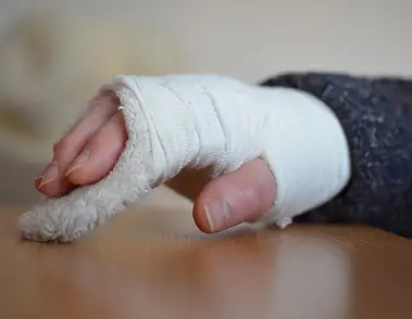 Krzywa ręka po gipsie: prosty powrót do zdrowia