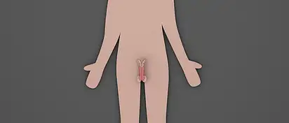 Gadżety wspomagające leczenie urologiczne - Nowe możliwości 