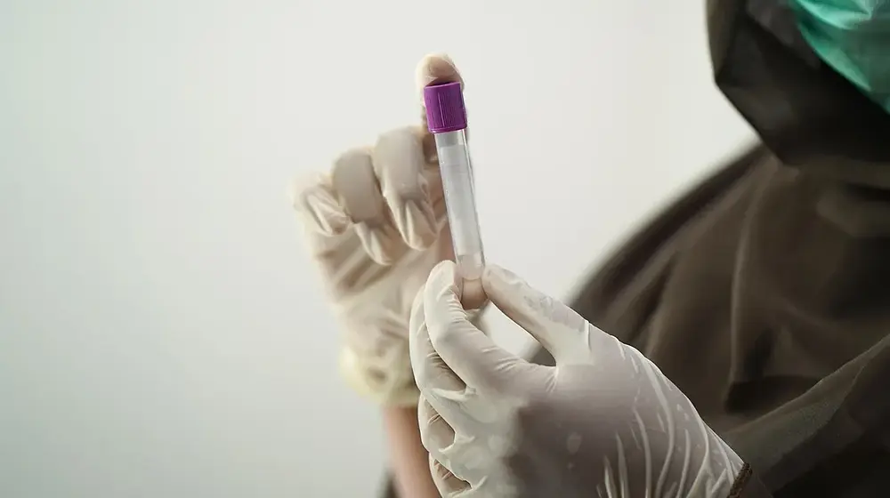 Jak wygląda badanie urologiczne i kiedy je wykonać?